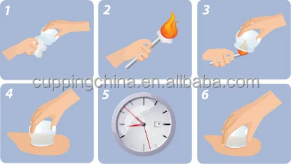 Набор для вакуумной терапии 5 стеклянных стаканчиков