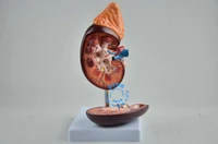 free shippingrenal anatomy modelthe anatomical model of human organsamplification of the kidney model1 5 timesteaching
