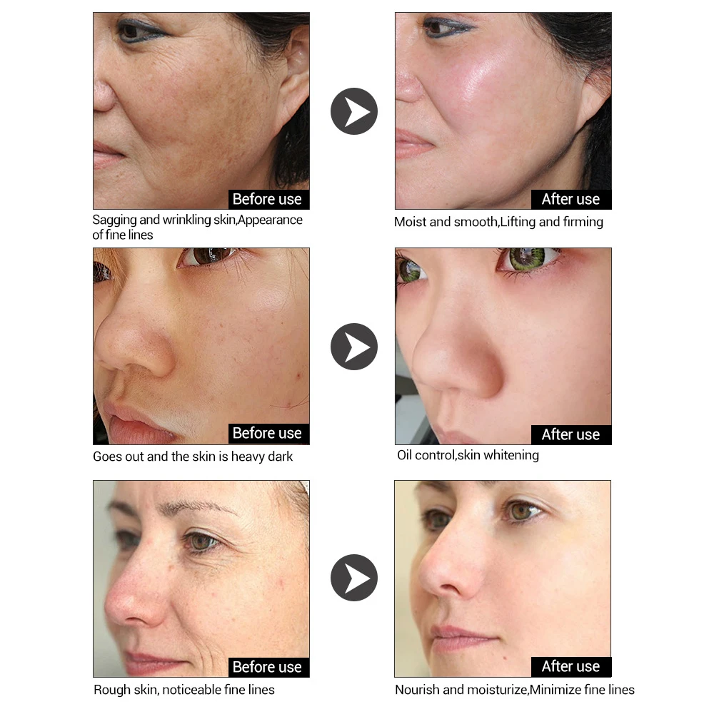 Сыворотка с гиалуроновой кислотой LANBENA увлажняющий крем для лица против морщин