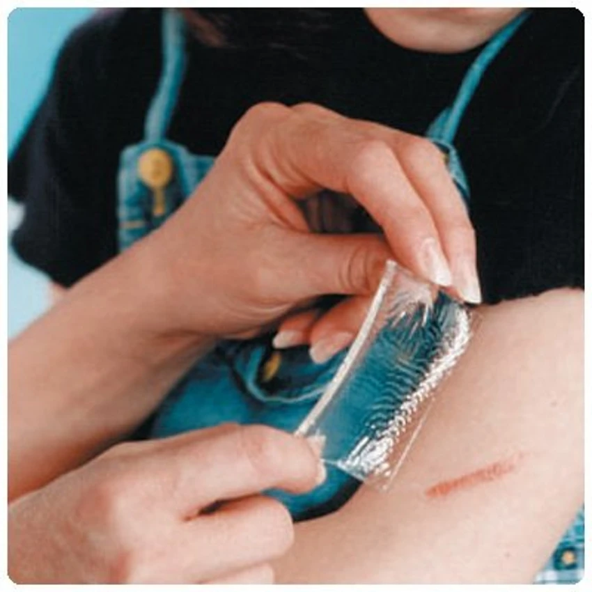 1 шт. силиконовый Патч Бесплатная доставка шрам удаление силикона для удаления