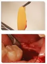 Центрифуга PRF центрифуга для богатых тромбоцитами фибринов крови при