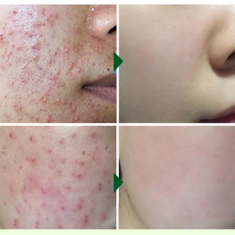 

Face Cleaning Lotion Serum Whitening Treatment Pore Repair Essence Face Care
