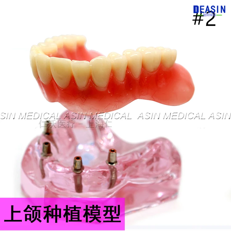 1 pc x high quality Resin Coverage dental implant model dentures Removable teeth for dentist study Deasin |