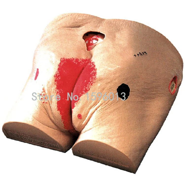 

Decubitus Ulcer Care Model