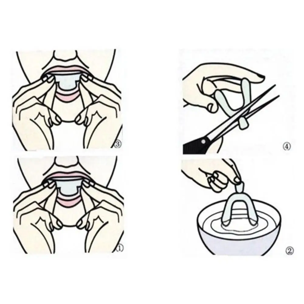 2/3 шт. накладок для ухода за зубами с термоформированием, отбеливающих ложек для отбеливания зубов, ортопедический мундштук для гигиены полости рта.