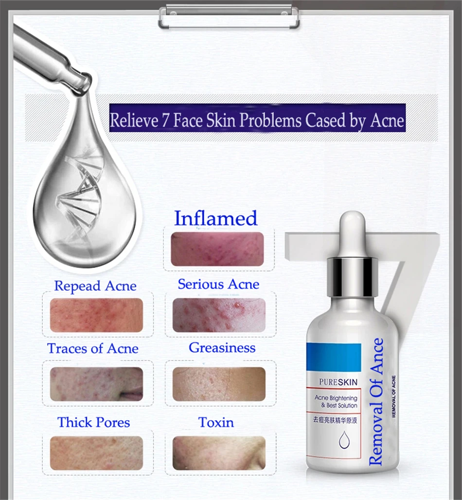 2 шт. Сыворотка для лица с корнем средство удаления шрамов от акне увлажняющий