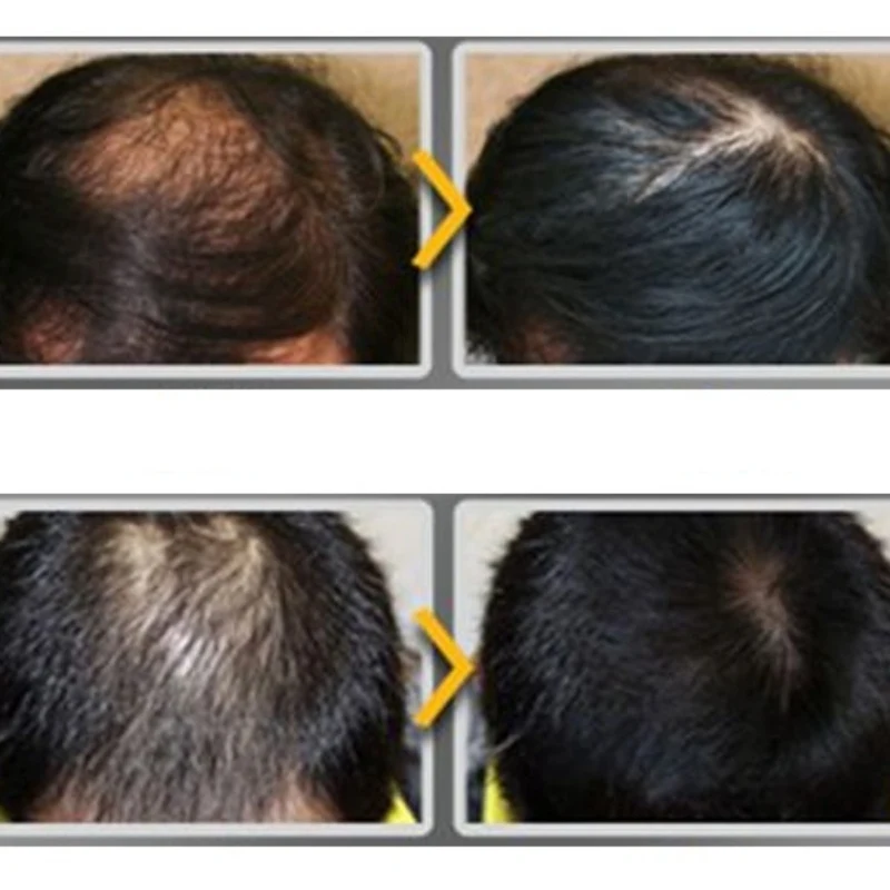 Эфирные масла для роста волос оригинальная аутентичная 100% Жидкая Сыворотка