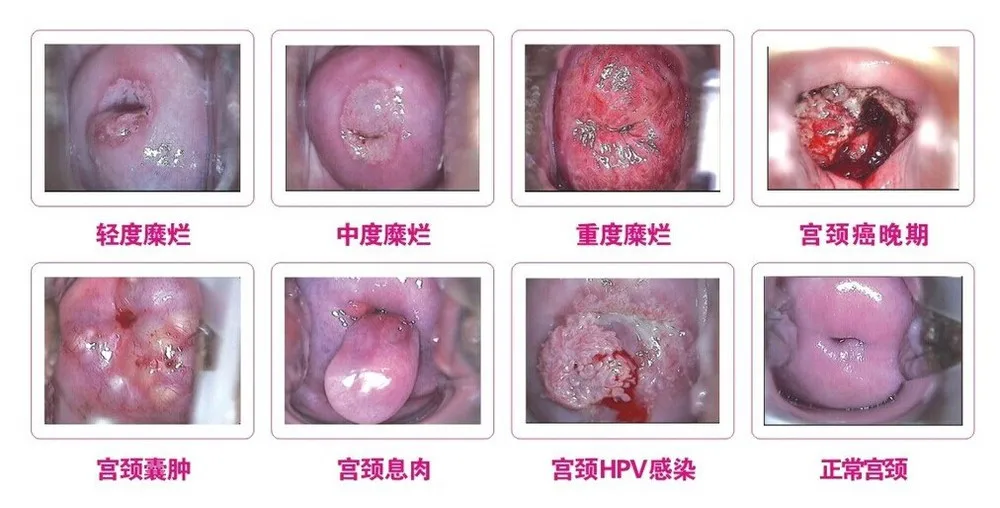 Female100% Nature Herbal Medicinal Vaginal Repair Beautiful Life Chinese Tampons Clean Point For Women 10 pcs/lot | Красота и