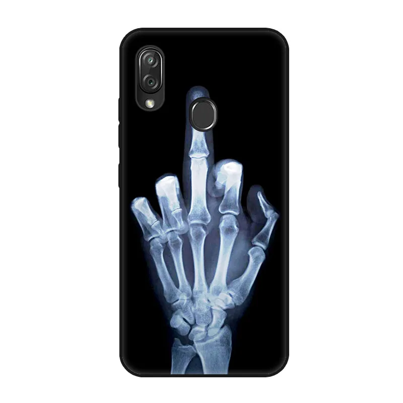 Funda For Xiaomi Redmi Note 7 Case RedmiNote 7 Black Silicone Soft Phone Case Redmi 7 7A Back Cover For Xiaomi Redmi 8A Case 8 A