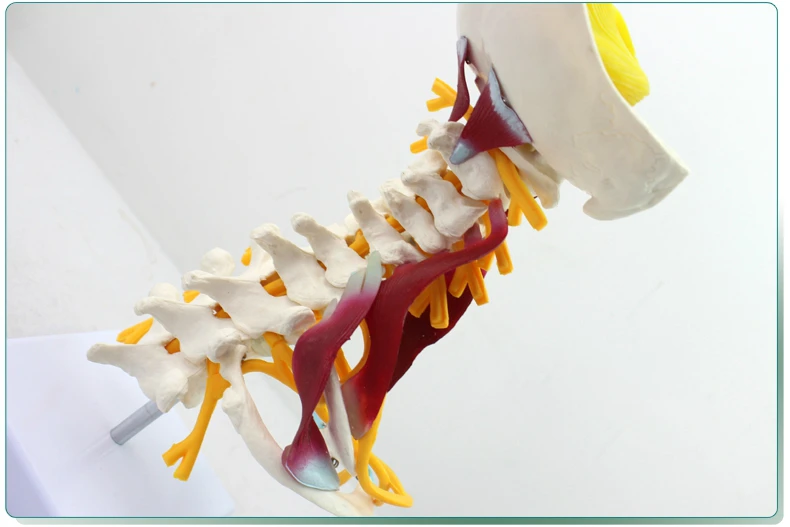 Медицинская модель шейного отдела позвоночника brachial plexus neuromuscular