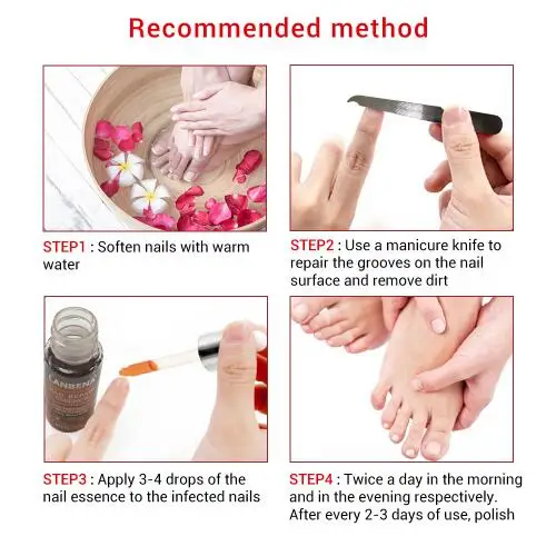 LANBENA nail repair essence serum Nail treatment of the fungus remove Onychomycosis feet nourishing brightening hand and foot ca |