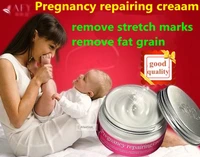 1pc cream from stretch marks for pregnant women creme para estrias maternidade pregnancy obesidad remove slack line