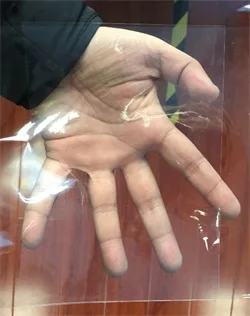 thumb
