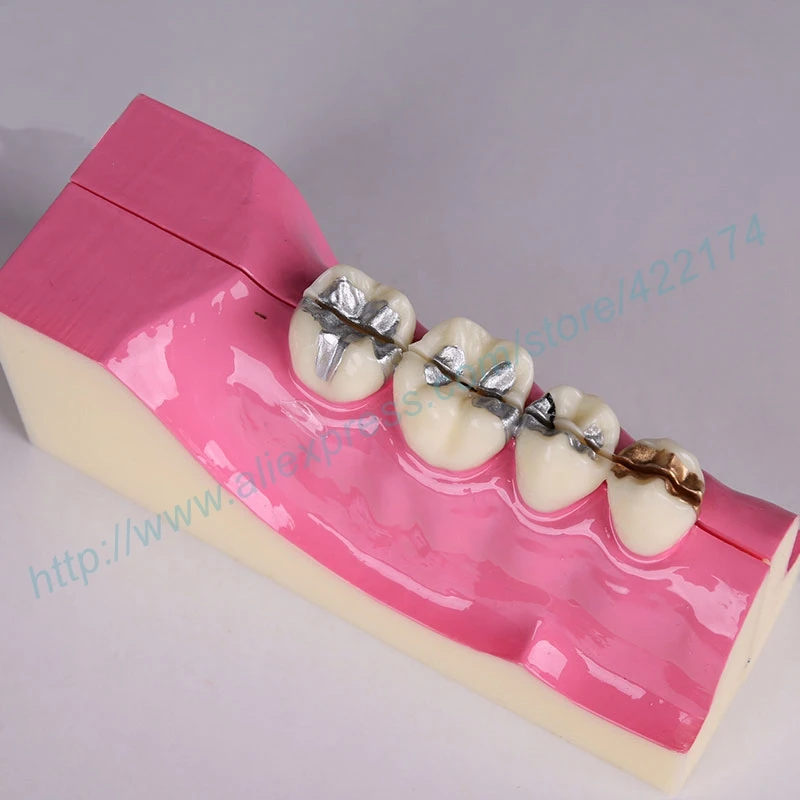 Молярный поперечный сечение модель исследования зубные зубы анатомическая