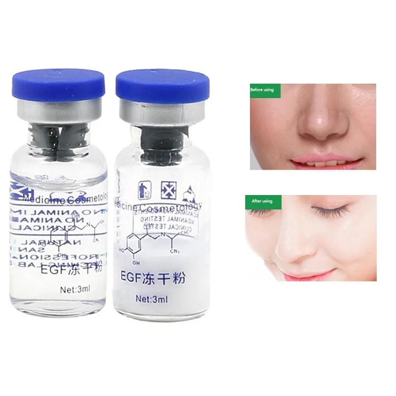 Lyophilized Epidermal фактор роста EGF 2 шт. порошковая Сыворотка для лечения акне прыщей