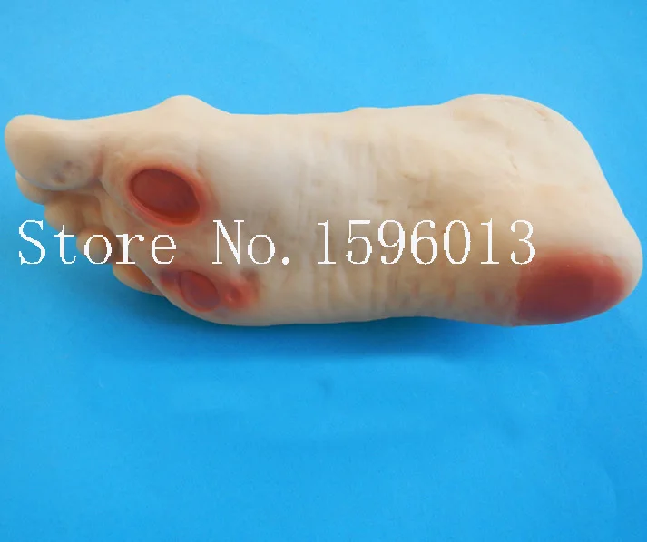 Горячий диабетический ножной имитатор ухода за младенцем диабетическая модель