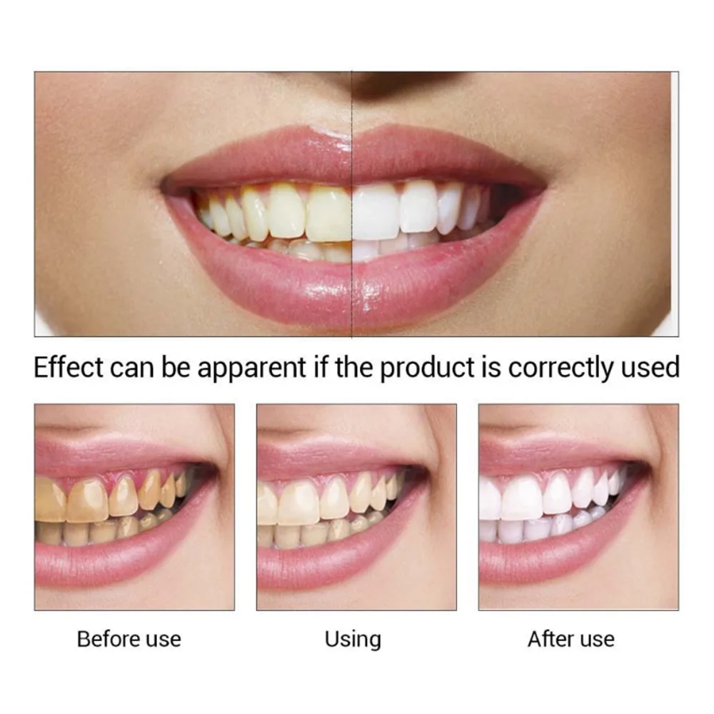 

LANBENA 10ml Teeth Care Whitening Essence Powder Oral Hygiene Cleaning Serum Removes Plaque Stains Tooth Bleaching Dental Tools