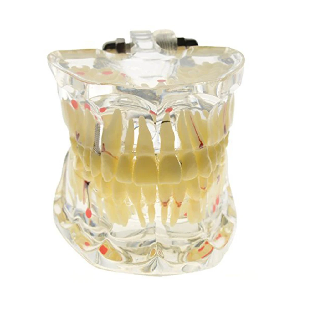 Promotion Dental Study Tooth Transparent Adult Pathological Teeth Model Dental Lab Equipment Dentist Teaching
Promotion Dental Study Tooth Transparent Adult Pathological Teeth Model Dental Lab Equipment Dentist Teaching