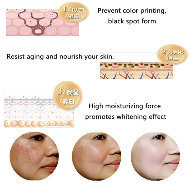 Эссенция для отбеливания всего тела гусиные удары прыщи фолликулит куриная кожа