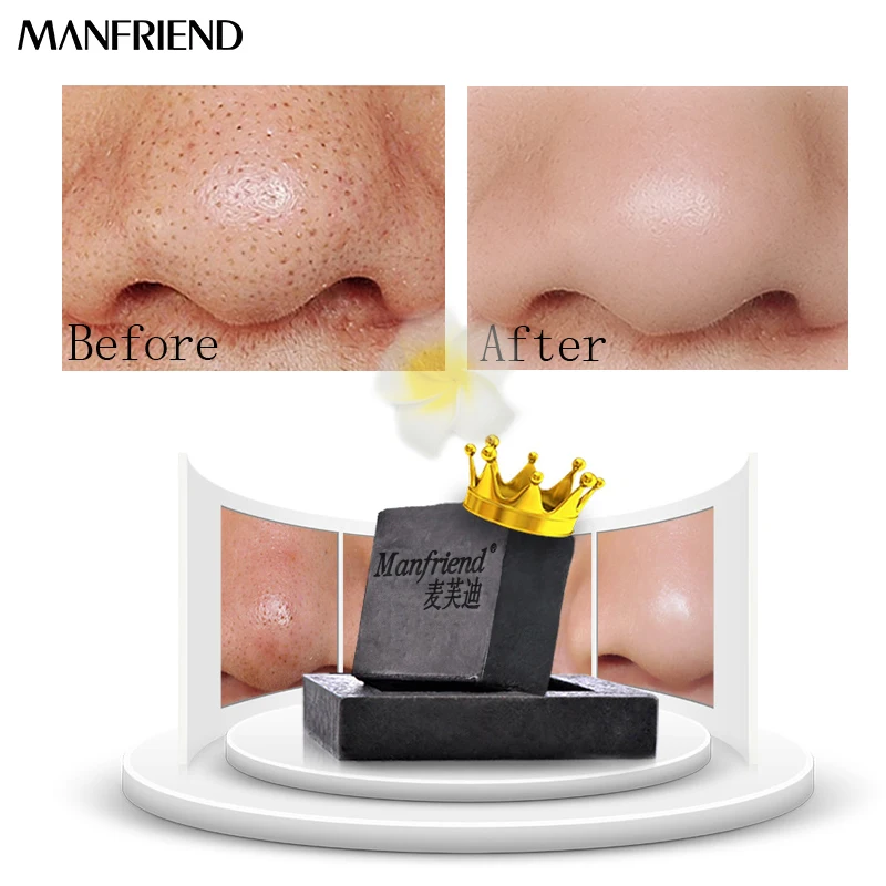 Средство для удаления угрей из бамбука и древесного угля лица глубокое очищение