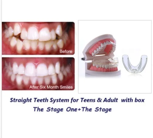 High-tech Dental Orthodontic Braces - Transparent Soft and Hard For Adults Teeth Straightening | Красота и здоровье