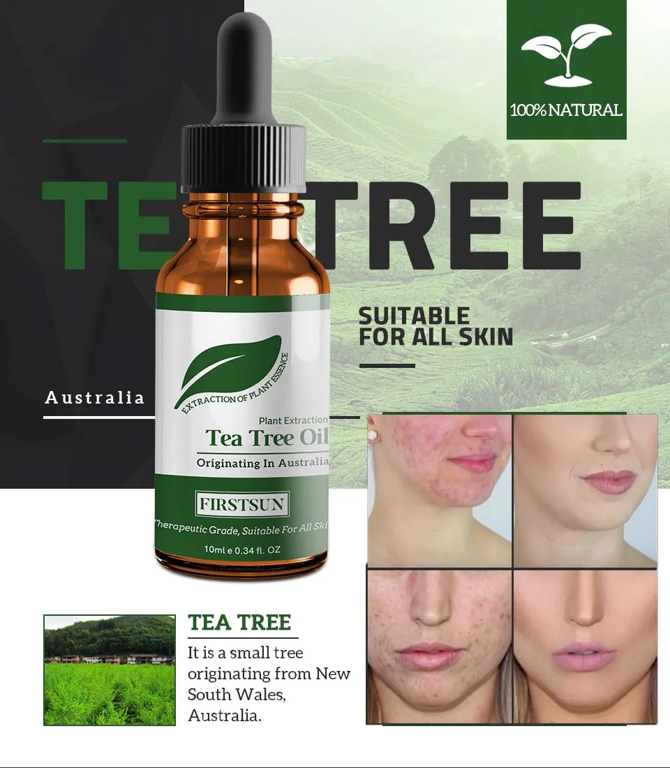 100% Natural Tea Tree Essential Oil Anti-wrinkle Extract Acne Removal Scars Marks Treatment Essential Oil for Any Skin CareTSLM1