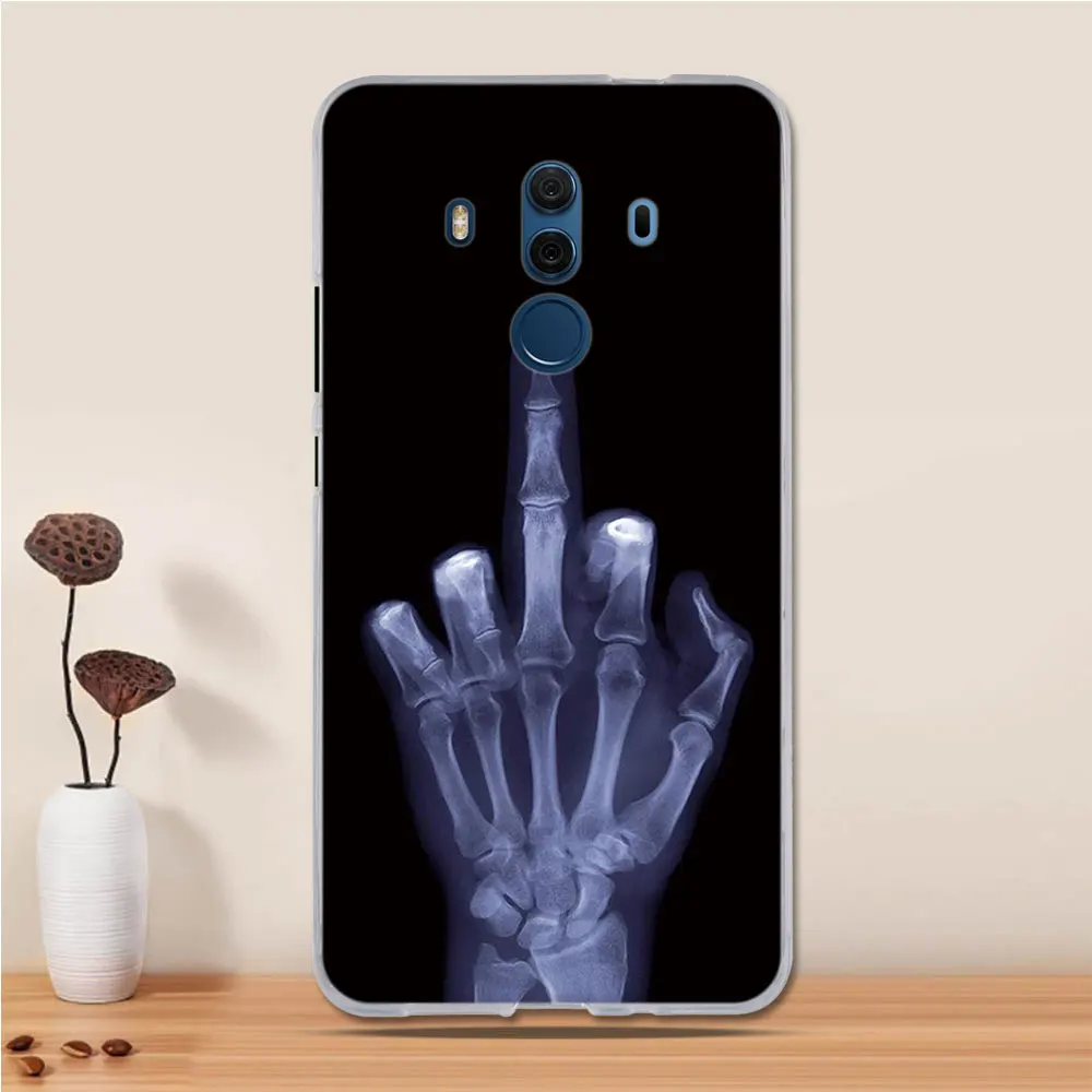 Чехол для huawei mate 10 Pro, силиконовый чехол для huawei mate 10 Pro, чехол из ТПУ, противоударный чехол для huawei mate 10 Pro, чехол