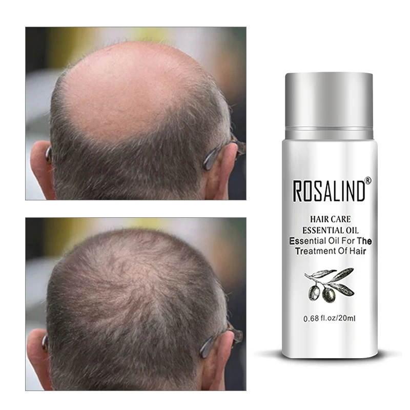 ROSALIND, кератиновая маска для лечения волос, сыворотка, маска для волос, Кератиновый шампунь для восстановления выпадения волос, сухой уход за повреждениями, масло для волос