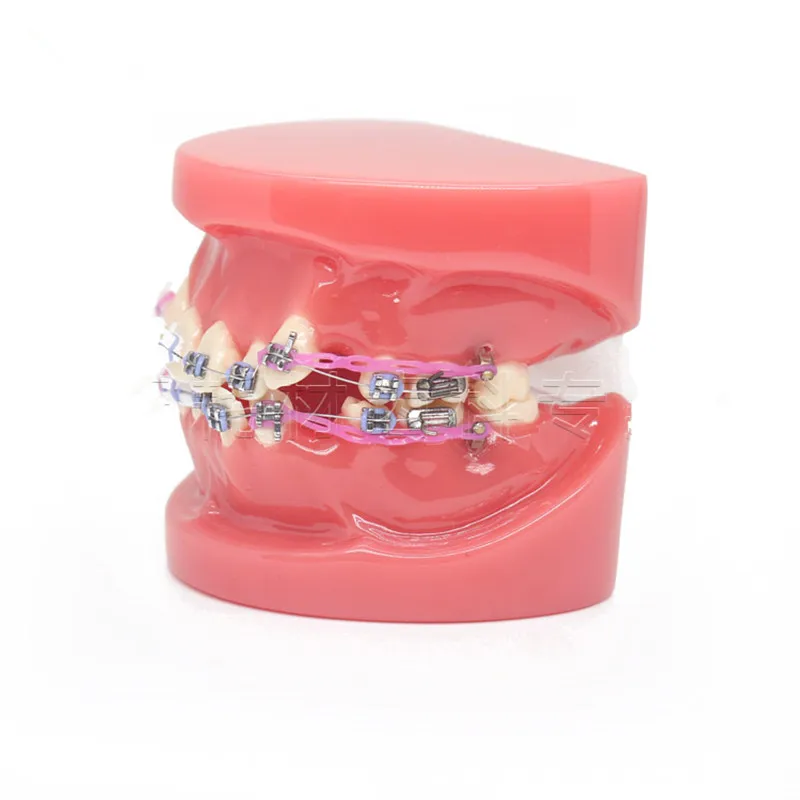 Новая Стоматологическая Ортодонтическая лечебная модель для прикуса с