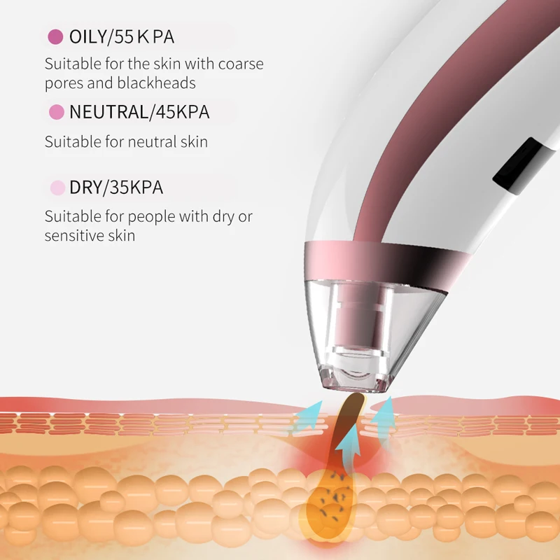 BlingBelle вакуумный угрей для удаления акне всасывающая машина пор пылесос Usb