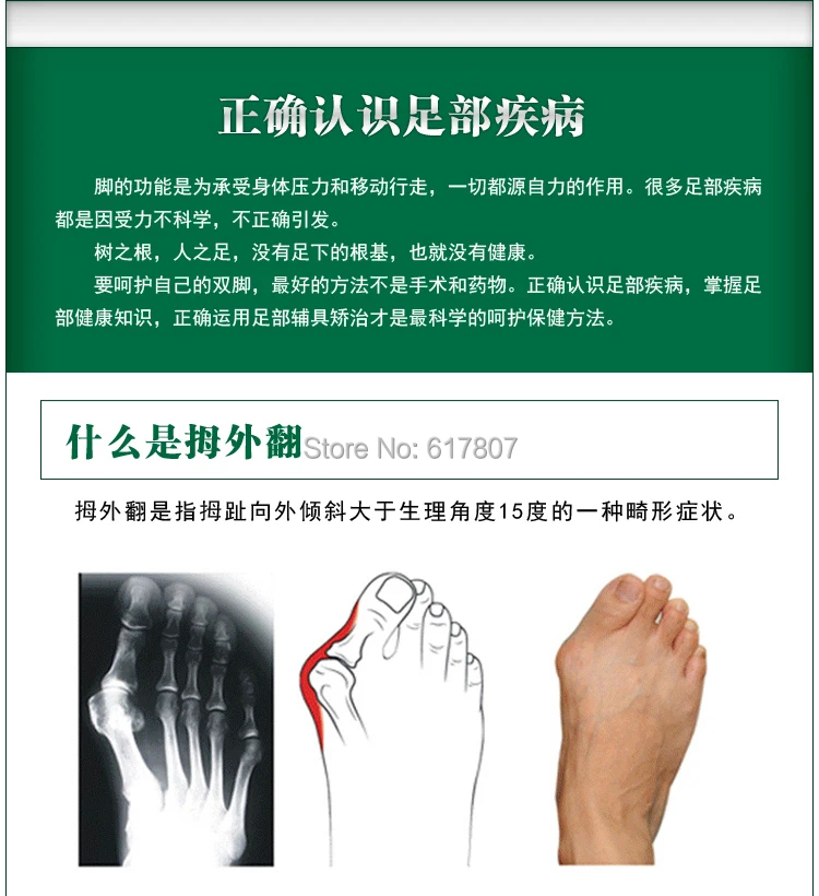 Самая низкая цена непосредственно с фабрики вальгусный силиконовый сепаратор