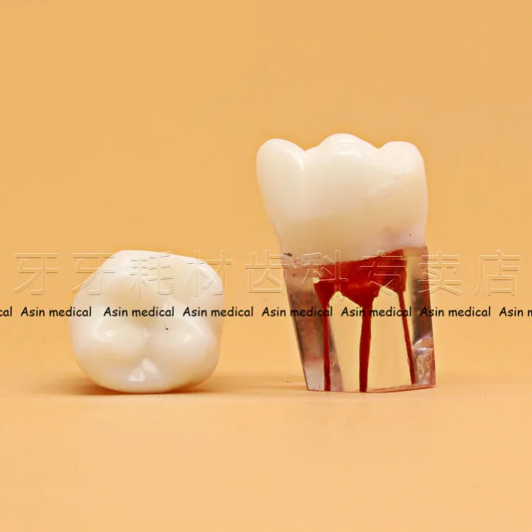 

High Quality Dentistry dental Exam Practice open pulp root canal model in vitro cavity .