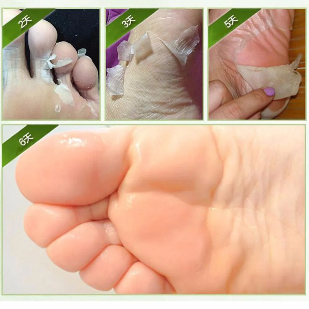 1 упаковка детский пилинг для ног крем-маска обновления кожи кутикулы пятки
