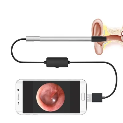 Otolaryngology эндоскоп oralexam инструмент cervix электронный кольпоскоп зеркало камера
