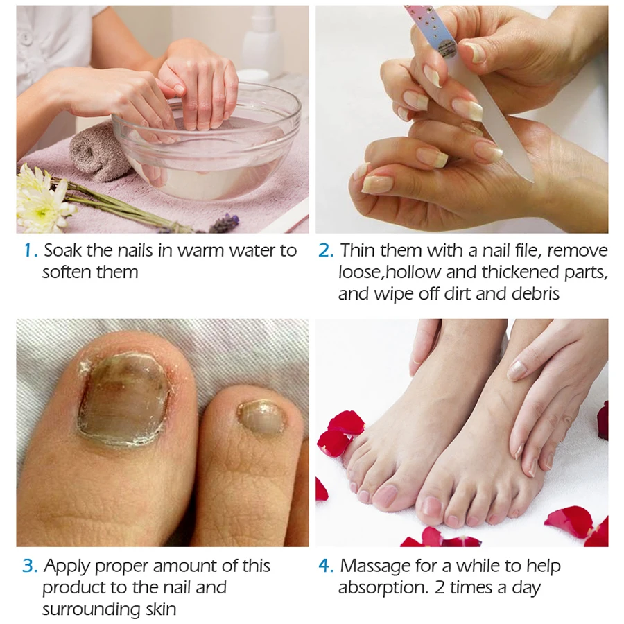 

VIBRANT GLAMOUR Nail Care Nail Repair Cream Nail Fungus Treatment Onychomycosis Removal Anti Fungus Nail Toe Repair Cream 20ML