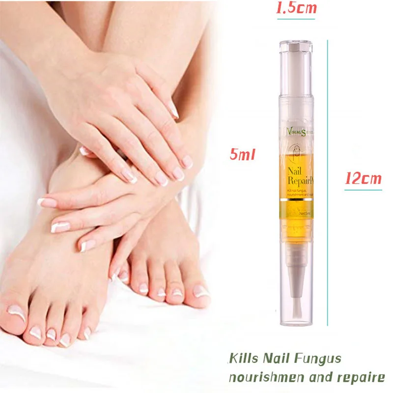 Hot 1pcs Nail Repair Anti Fungal Treatment Pen Onychomycosis Paronychia Infection Herbal Toe Finger Nutrition Health | Красота и