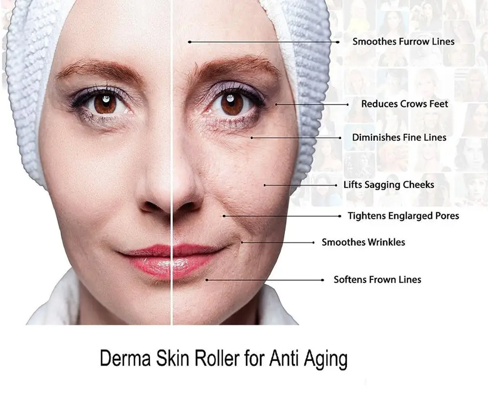 Дерма ролик 540 микроedle комплект для лица тела микродермабразия косметический