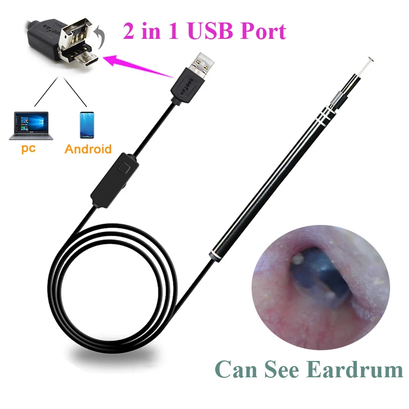 

Медицинский USB-инструмент для чистки ушей, визуальный HD-монитор, отоскоп с мини-камерой, ручка для ухода за ушами, внутриканальный эндоскоп д...