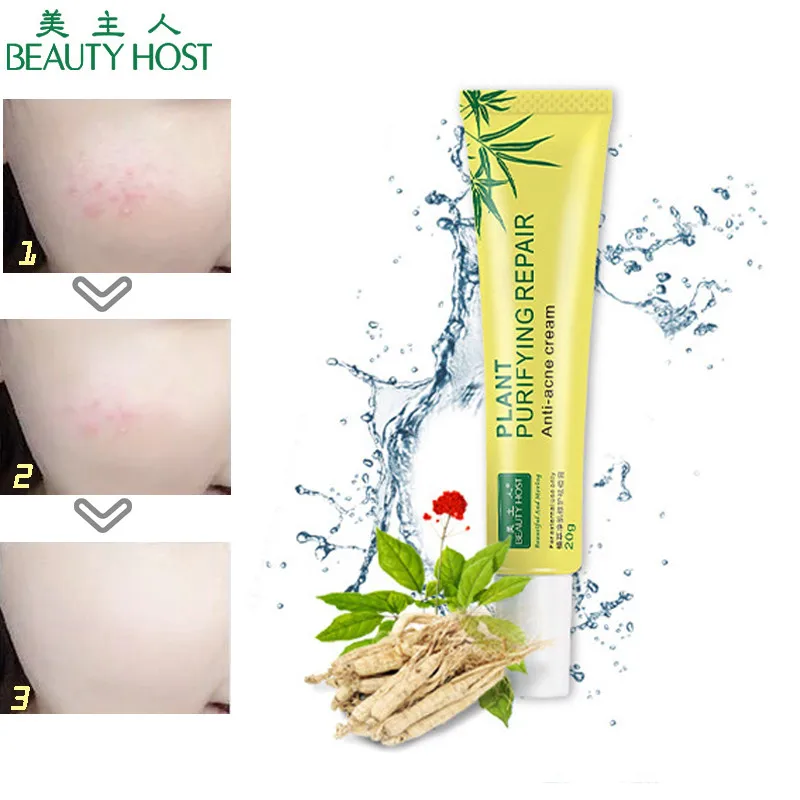 Лечение акне крем анти лечение от прыщей отбеливание увлажняющий растение