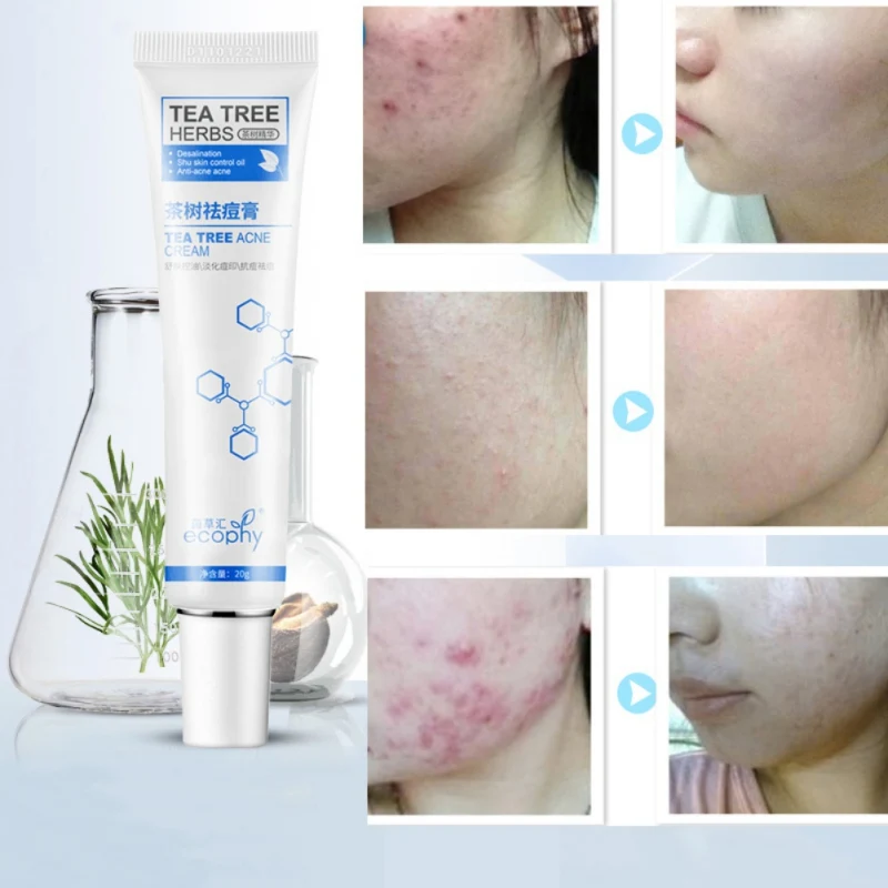 Женский противовоспалительный уход за кожей бесageless крем от акне лечение шрамов