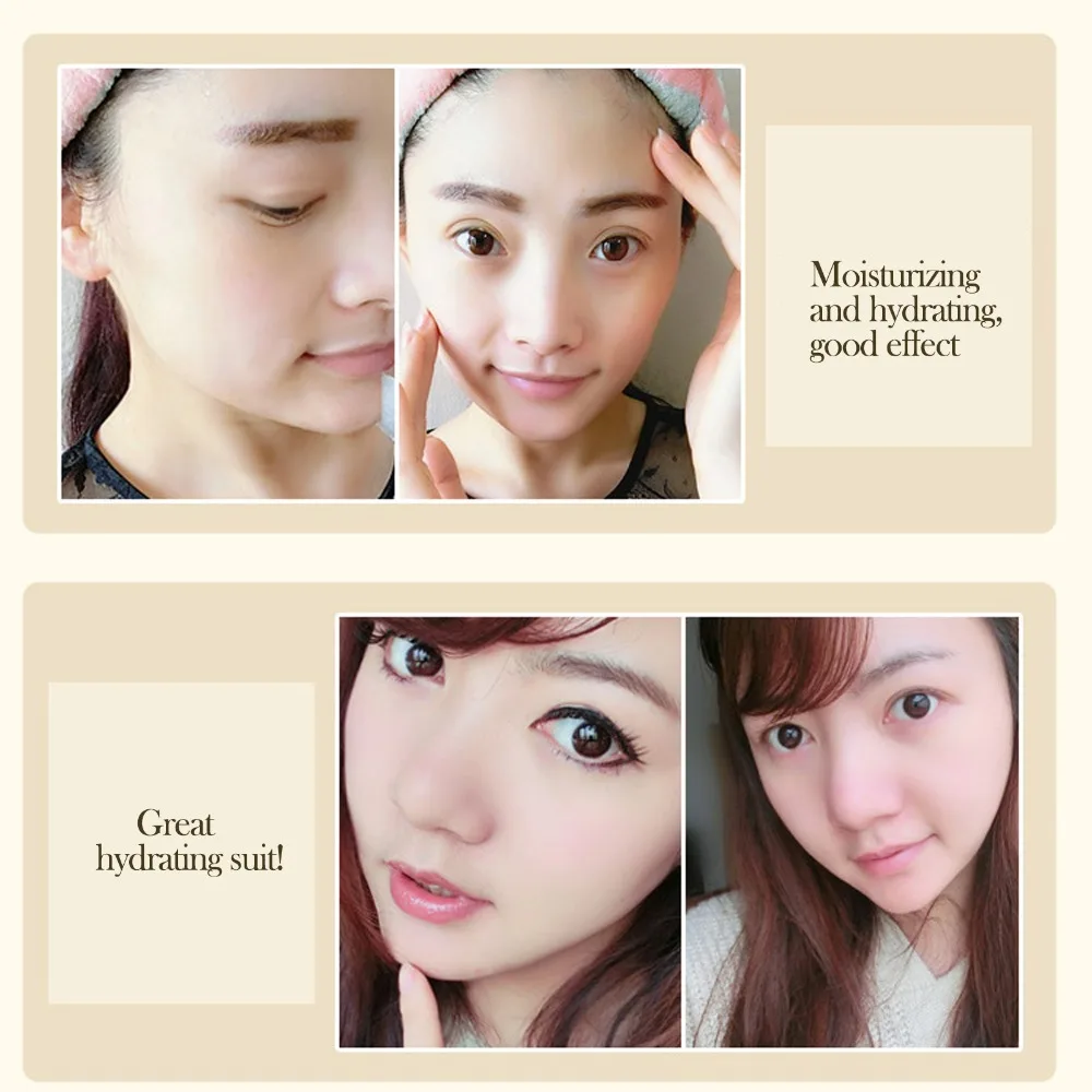 5 шт./компл. увлажняющий набор для ухода за кожей и акне средство очищения лица