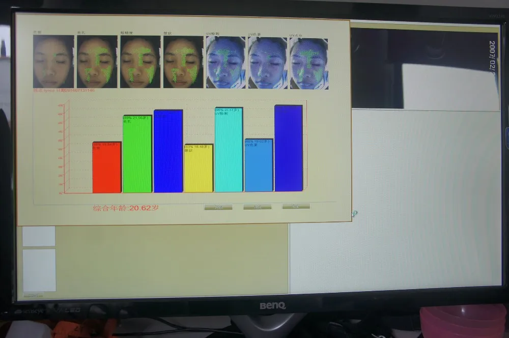 

Skin Diagnosis Beauty Equipment 3D Skin Analyzer / Scanner from china