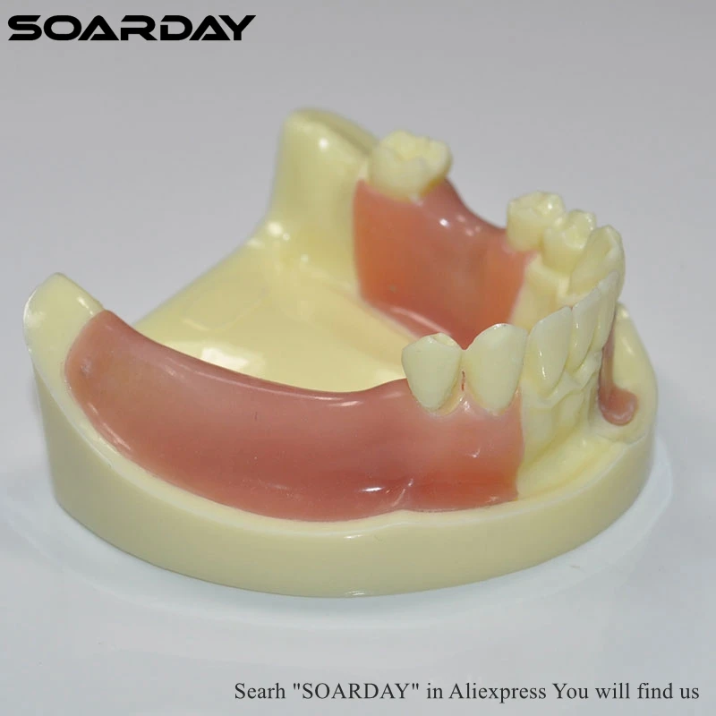SOARDAY 1 шт. модель для тренировки имплантации различных зубов отсутствует с