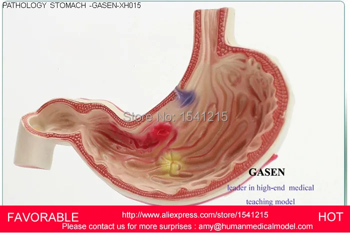 Анатомическая модель желудка анатомия анатомии человека желудочно кишечного