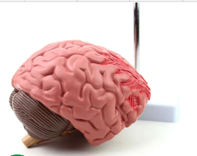 Модель мозговых заболеваний человека анатомическая модель мозга нейрохирургии