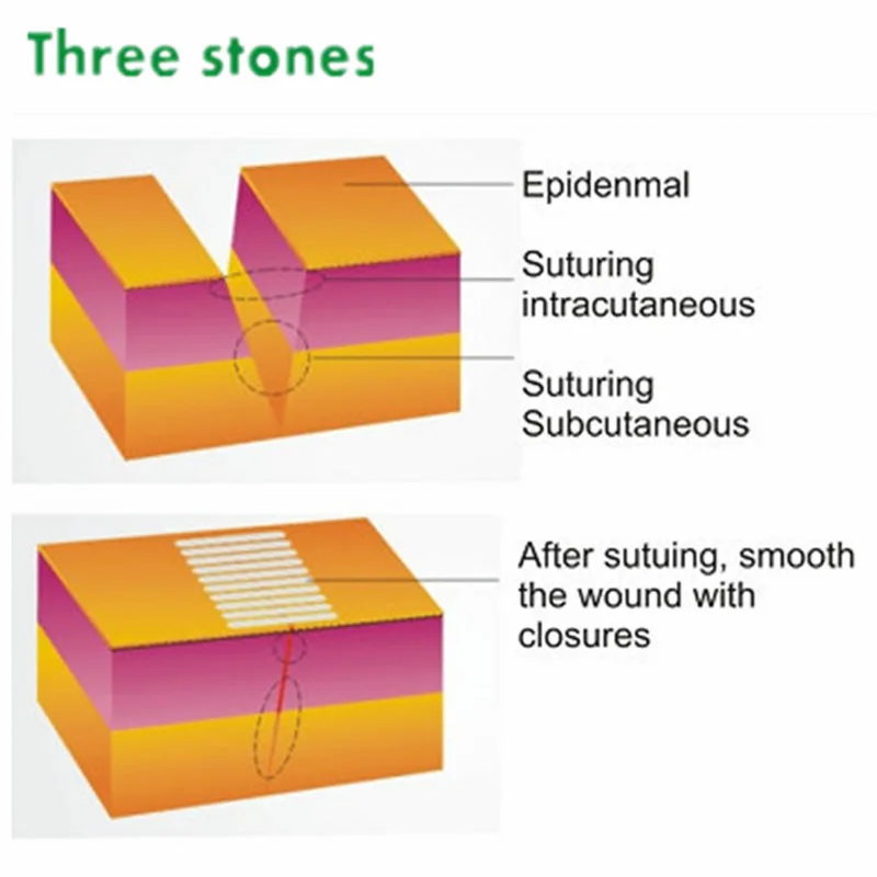 6*100 мм 10 полосок в упаковке|tape tape|tape medicaltape bag |