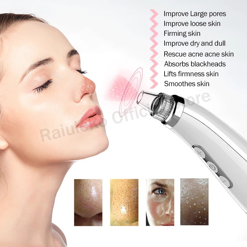 Дермабразия машина Blackhead пылесос всасывание удаление для постугревых рубцов