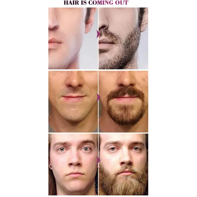 Beard Body Hair Eyebrow Care Men Styling Moustache Oil Growth Of Follicle Repair Moisturizing Smoothing Liquid | Красота и здоровье