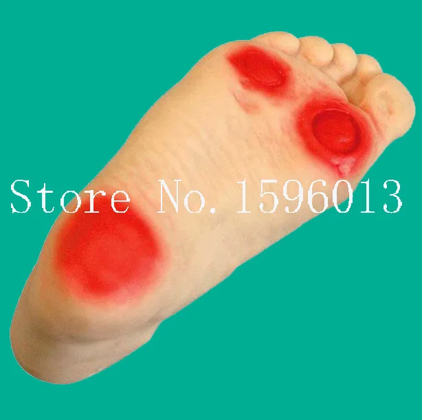 Горячий диабетический ножной имитатор ухода за младенцем диабетическая модель