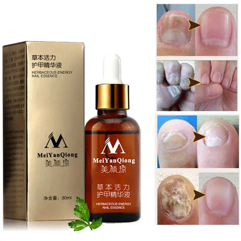 Инструмент для ухода за ногами Ingrown коррекция ногтей носочки кусачки для стрижки кусачки для удаления грязи из мертвой кожи+ Paronychia Podiatry педикюр